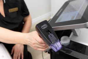 A close-up photo of the applicator we use for RF microneedling in Thunder Bay, ON.
